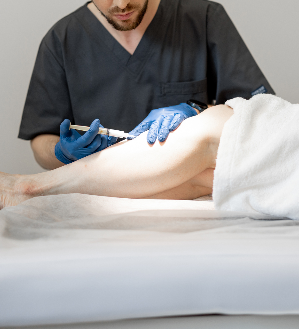 Preventing Spider Veins From Recurring in the Future