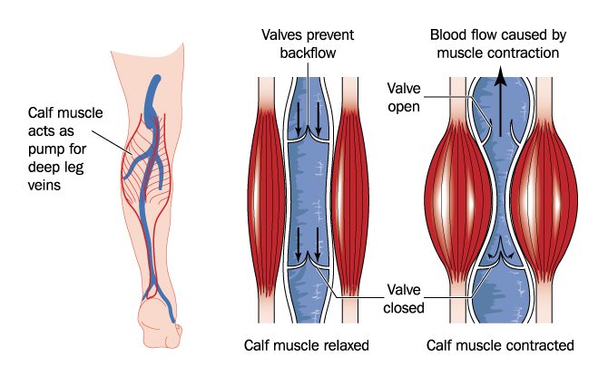 Understanding How Varicose Veins Affect Daily Life